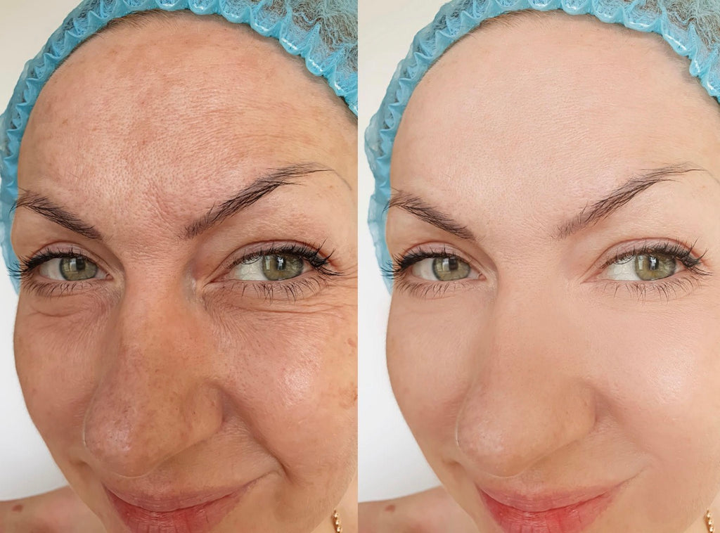 ✨ Collagène Glow – Peau ferme, lisse & éclatante (Marin Hydrolisé)